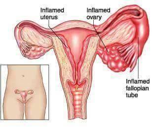 Vaginal tightening herbs, vaginal Odor herbs in Durban+27 71 009 6483